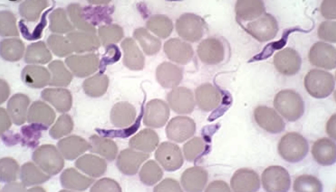 A Live Blood pHase Contrast Microscopy Micrograph of Trypanosoma cruzi Parasite.webp