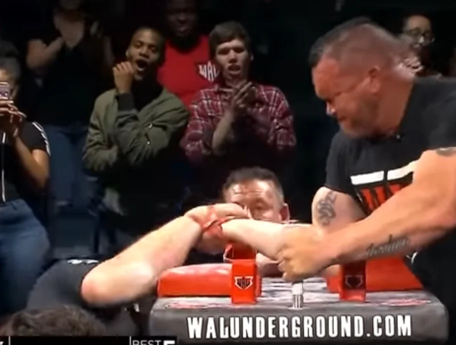 Matt Mask kyynärpää.webp