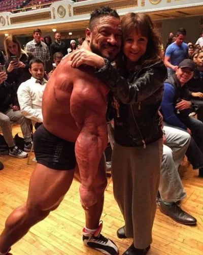 roelly_triceps.webp roelly_triceps.webp