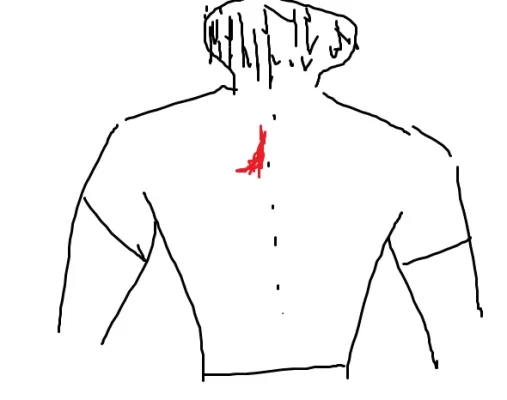 injury.webp injury.webp