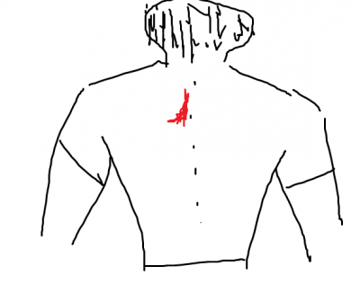 injury.png