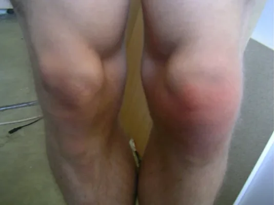 knee.webp