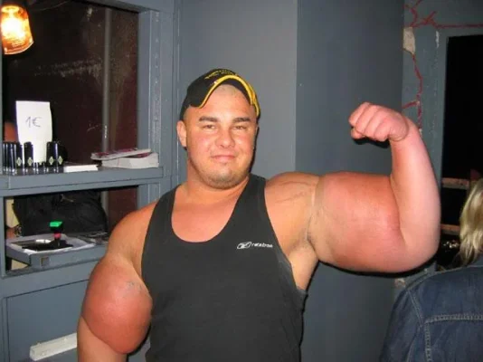 muscle.webp