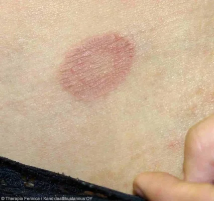 639px-TFA_1821.webp 639px-TFA_1821.webp