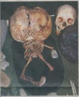 brazil-star-child-skull-skeleton.jpg