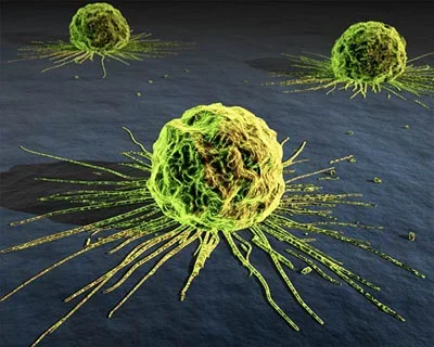 cancer_cells.webp