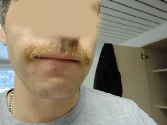 movember_day29_.webp