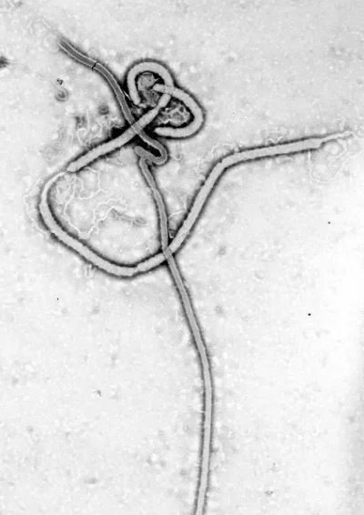 424px-Ebola_virus_em.webp