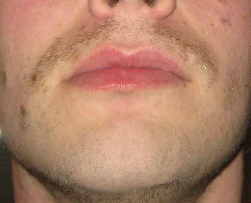 movember2.webp