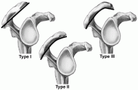 acromion-picture.gif