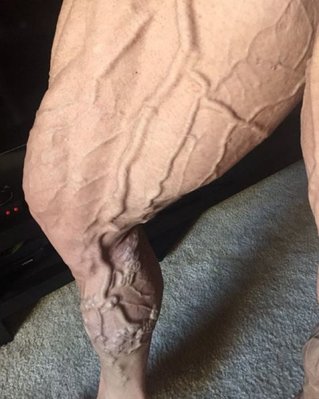 veins.JPG